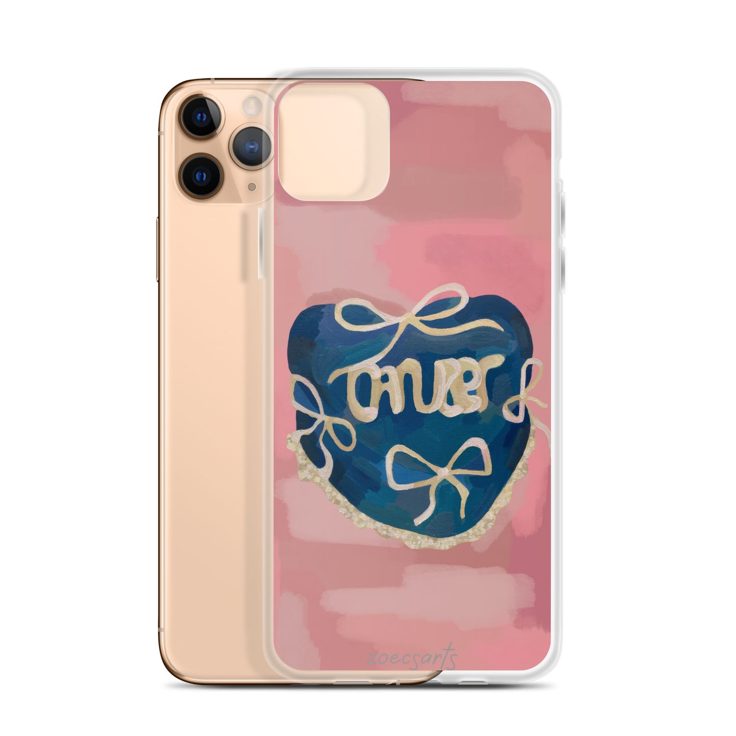 ‘CANCER’ phone case